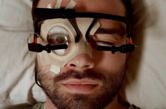 Scientists Stored Folks’s Eyes Open Whereas They...